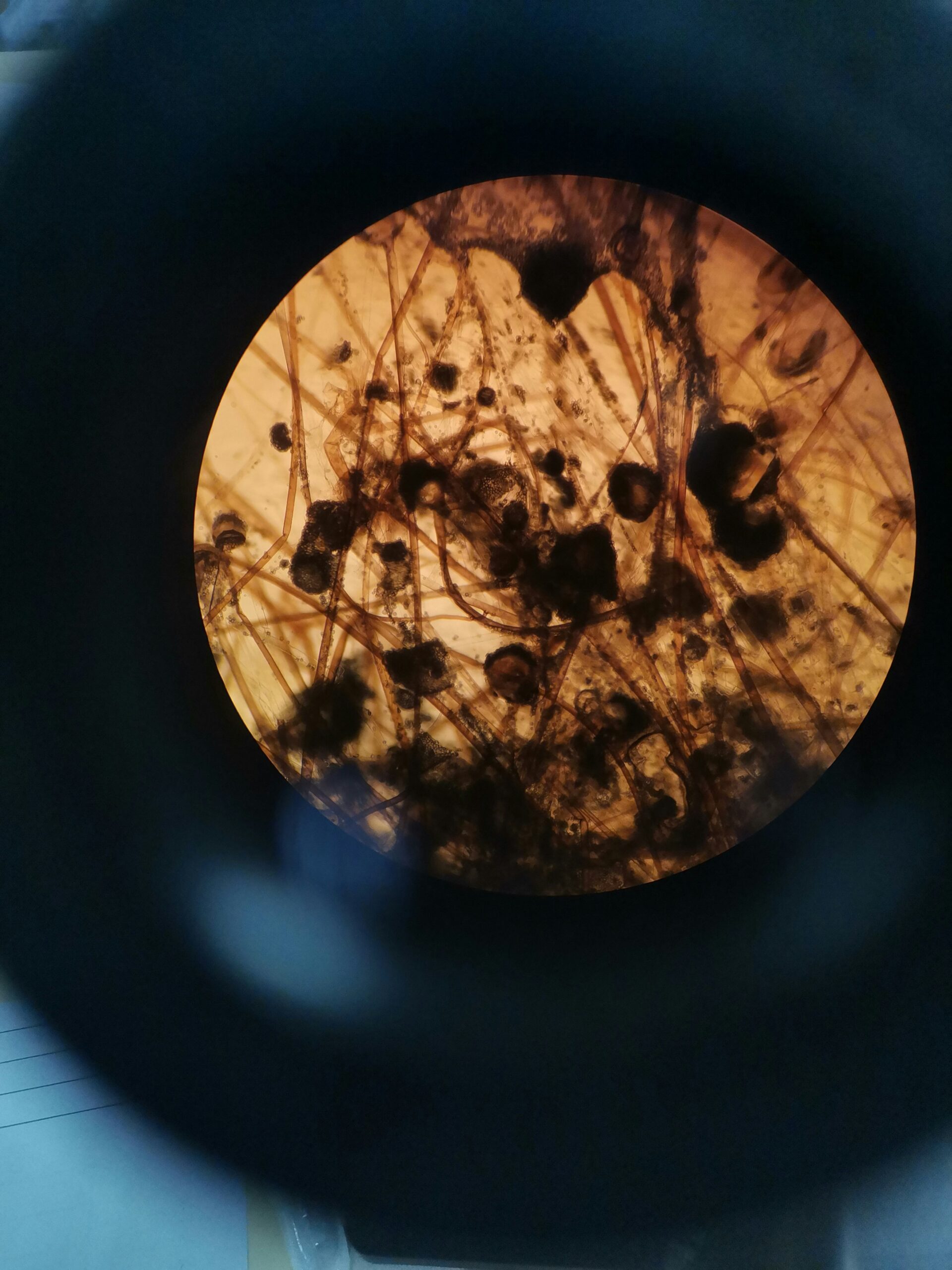 Schimmel in der Wohnung